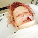 0421burgbeatingvictim1web